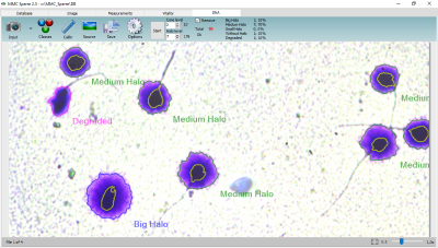 MMC Sperm DNA Fragmentation